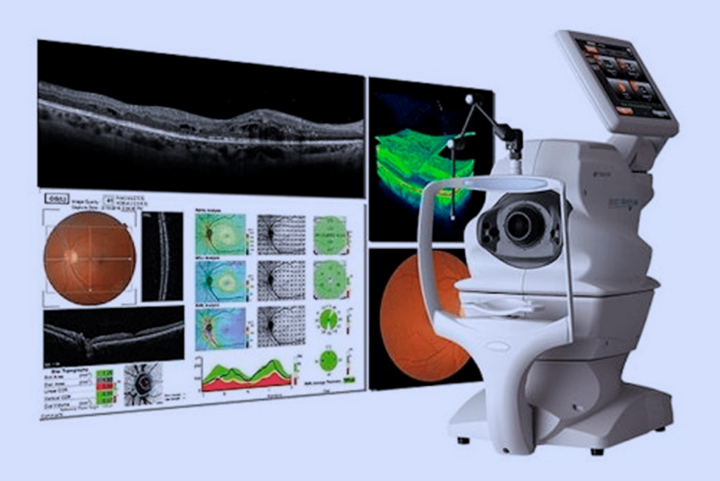 O que é Tomografia de Coerencia Optica