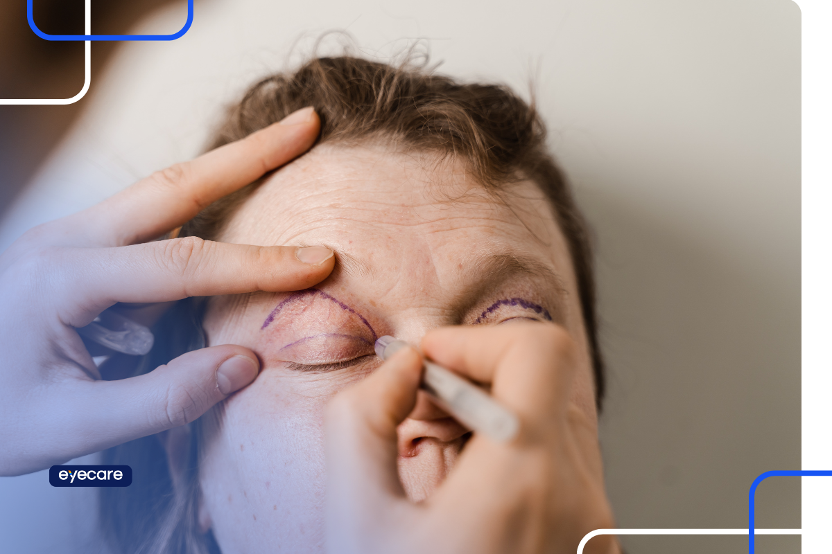 Jet Plasma nos olhos: resultados, cuidados e orientação médica