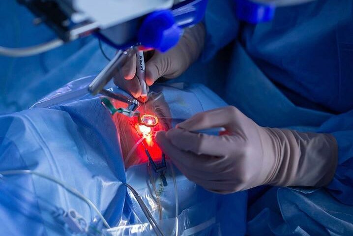 Cirurgia de retina e vítreo avanços e atualizações