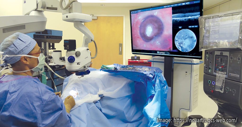 plataforma de cirurgia vitreorretiniana-digitalmente assistida