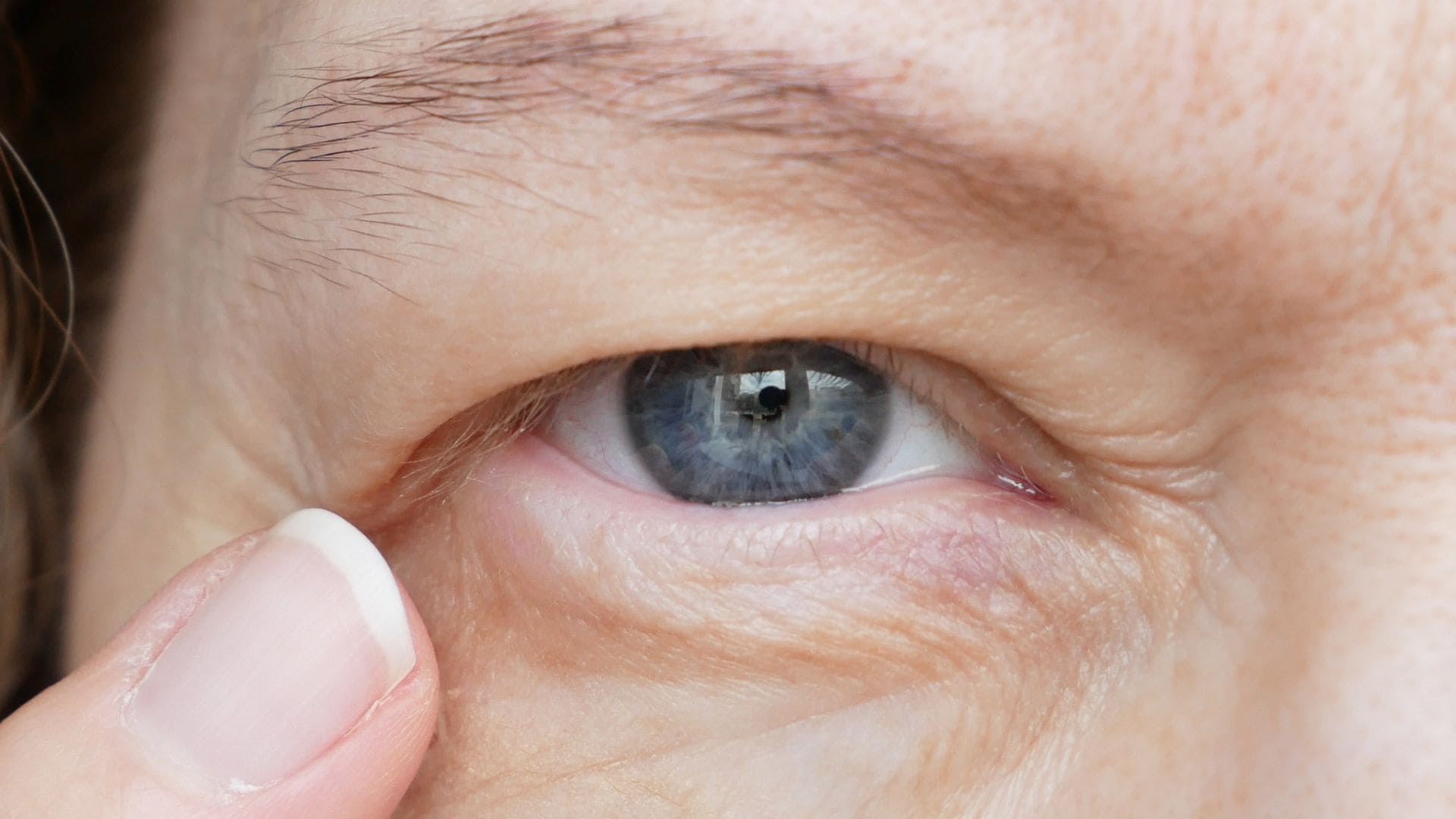 Olho Tremendo ou Tremor palpebral: o que é, causas e tratamento adequado