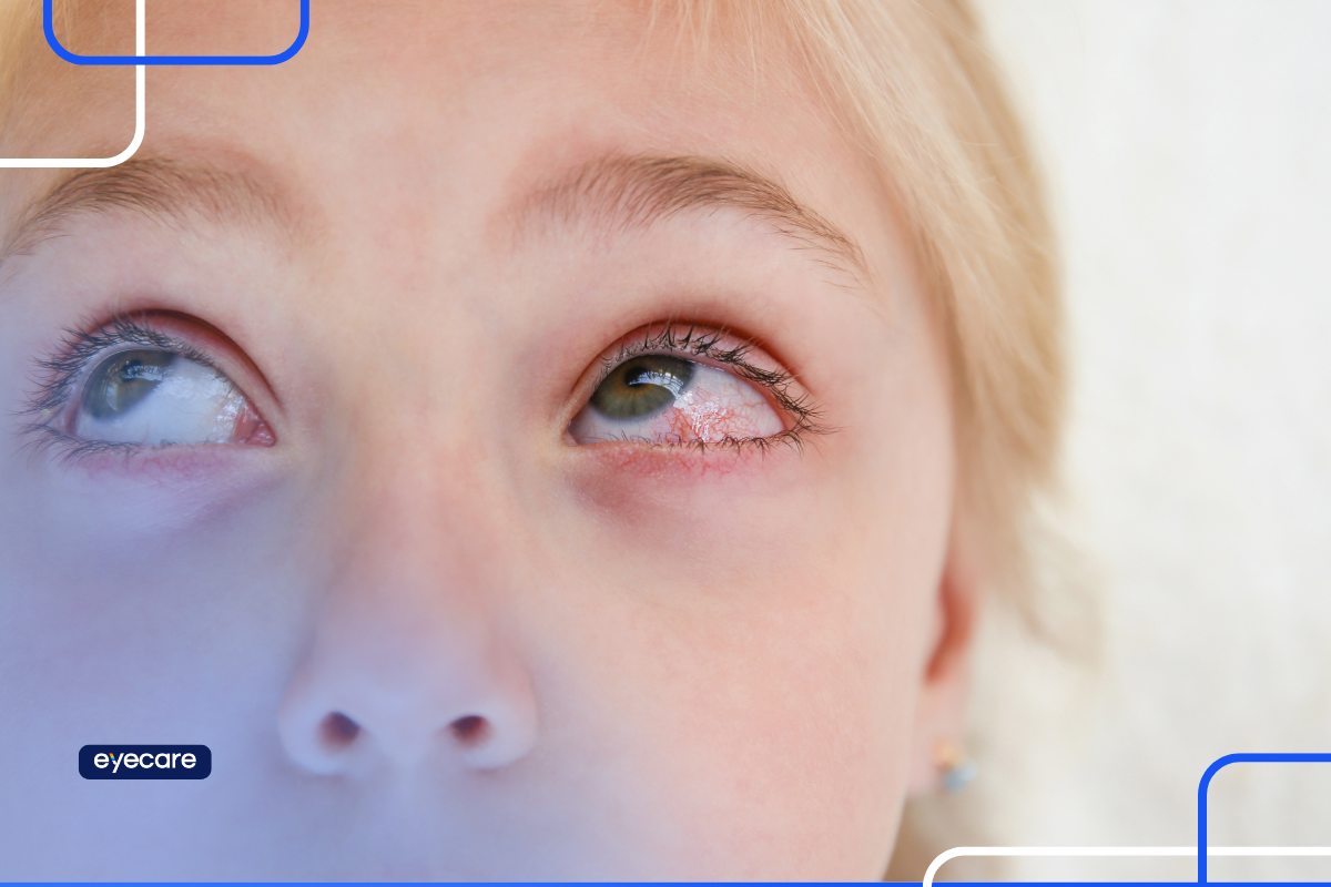 Eyecare Health Blog