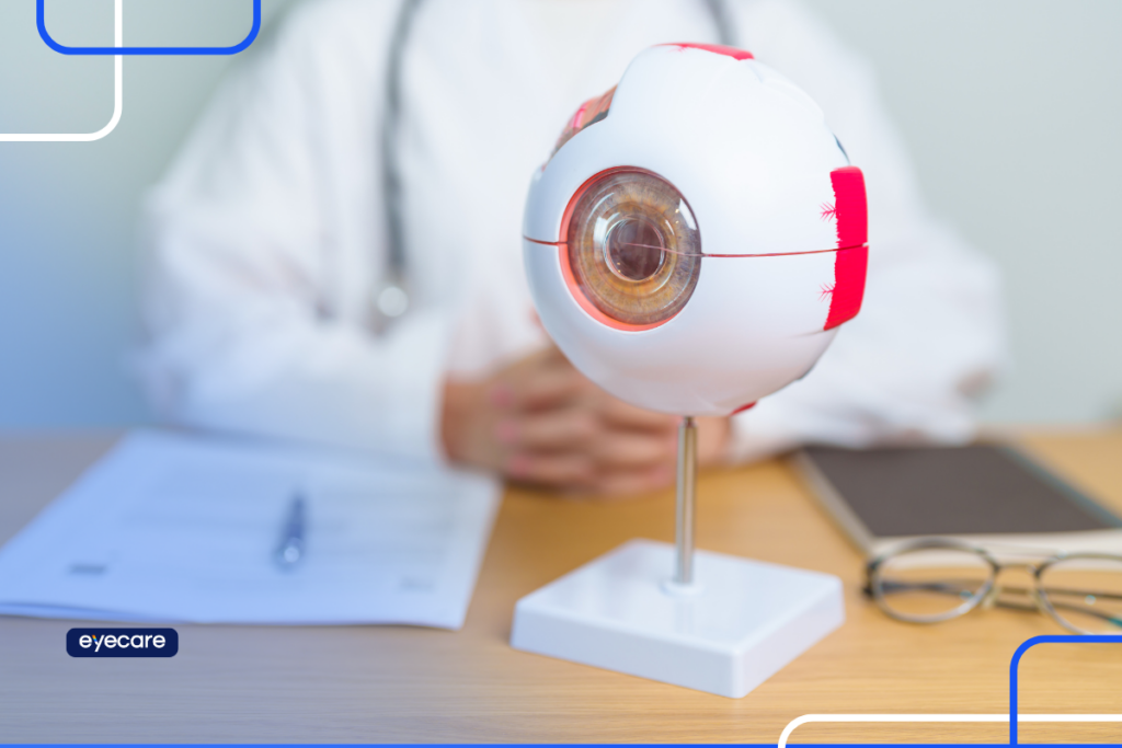 Glaucoma: o que é e quais os fatores de risco Glaucoma: o que é e quais os fatores de risco
