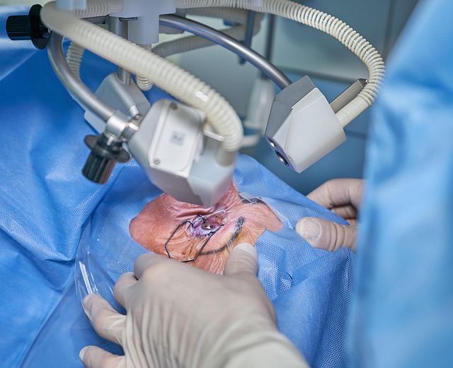 Cirurgia de Pterígio: procedimento, recuperação e resultados