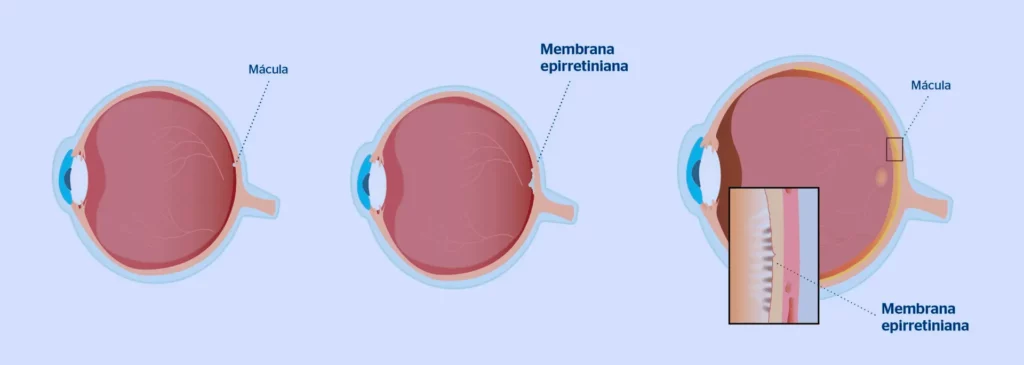 Função e Estrutura da Mácula