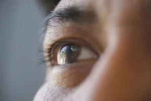 Close-up de olho com possível deformação da córnea, ilustrando o tema "ceratocone tem cura".