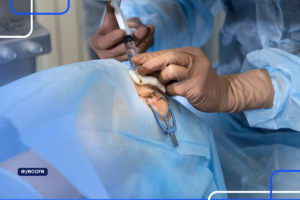 Cirurgia de correção de grau: o que é e como funciona