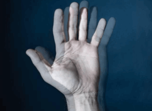 Diplopia Pós-AVC: Avaliação Oftalmológica e Tratamento
