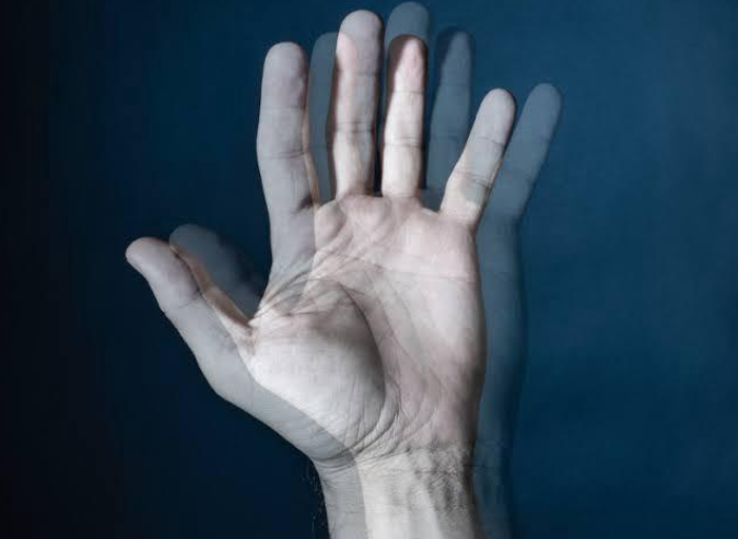 Diplopia Pós-AVC: Avaliação Oftalmológica e Tratamento