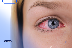 derrame no olho - Blog